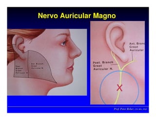 Prof. Peter Reher, CD, MSc, PhDProf. Peter Reher,Prof. Peter Reher, CD,CD, MScMSc,, PhDPhD
Nervo Auricular MagnoNervo Auricular MagnoNervo Auricular Magno
 
