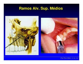 Prof. Peter Reher, CD, MSc, PhDProf. Peter Reher,Prof. Peter Reher, CD,CD, MScMSc,, PhDPhD
Ramos Alv. Sup. MédiosRamosRamos AlvAlv.. SupSup. M. Méédiosdios
 
