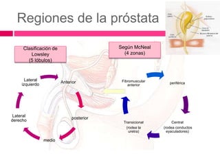 Regiones de la próstata 
Lateral 
Anterior 
izquierdo periférica 
posterior 
medio 
Lateral 
derecho 
Central 
(rodea conductos 
eyaculadores) 
Fibromuscular 
anterior 
Transicional 
(rodea la 
uretra) 
Clasificación de 
Lowsley 
(5 lóbulos) 
Según McNeal 
(4 zonas) 
 