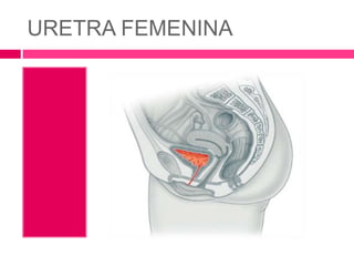 URETRA FEMENINA 
 