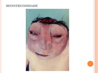 MONSTRUOSIDADE
 