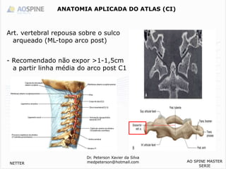 Dr. Peterson Xavier da Silva
medpeterson@hotmail.com
Art. vertebral repousa sobre o sulco
arqueado (ML-topo arco post)
- Recomendado não expor >1-1,5cm
a partir linha média do arco post C1
ANATOMIA APLICADA DO ATLAS (CI)
NETTER
AO SPINE MASTER
SERIE
 