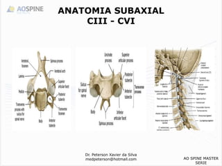 Dr. Peterson Xavier da Silva
medpeterson@hotmail.com
ANATOMIA SUBAXIAL
CIII - CVI
AO SPINE MASTER
SERIE
 