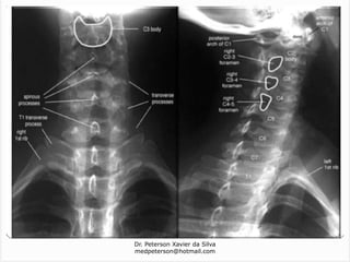Dr. Peterson Xavier da Silva
medpeterson@hotmail.com
 