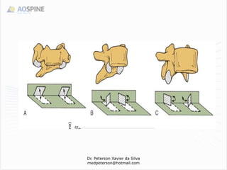 Dr. Peterson Xavier da Silva
medpeterson@hotmail.com
 
