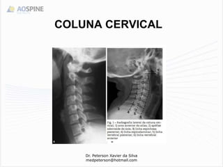 COLUNA CERVICAL
Dr. Peterson Xavier da Silva
medpeterson@hotmail.com
 