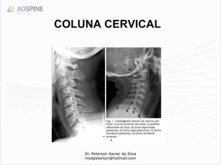 COLUNA CERVICAL
Dr. Peterson Xavier da Silva
medpeterson@hotmail.com
 