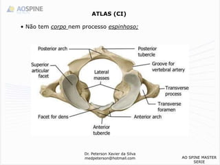 ATLAS (CI)
Dr. Peterson Xavier da Silva
medpeterson@hotmail.com
• Não tem corpo nem processo espinhoso;
AO SPINE MASTER
SERIE
 