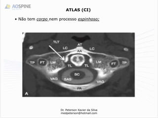 Dr. Peterson Xavier da Silva
medpeterson@hotmail.com
ATLAS (CI)
• Não tem corpo nem processo espinhoso;
 