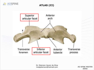 ATLAS (CI)
Dr. Peterson Xavier da Silva
medpeterson@hotmail.com AO SPINE MASTER
SERIE
 