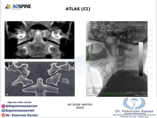 ATLAS (CI)
AO SPINE MASTER
SERIE
 