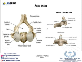 ÁXIS (CII)
AO SPINE MASTER
SERIE
VISTA ANTERIOR
 