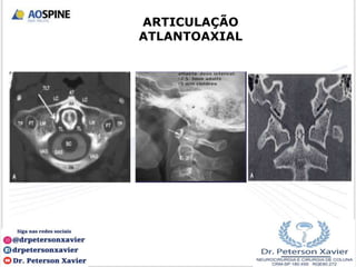 ARTICULAÇÃO
ATLANTOAXIAL
 