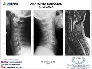 AO SPINE MASTER
SERIE
ANATOMIA SUBAXIAL
APLICADA
 