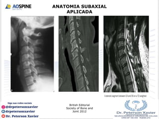 British Editorial
Society of Bone and
Joint 2012
ANATOMIA SUBAXIAL
APLICADA
 