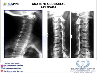 ANATOMIA SUBAXIAL
APLICADA
 