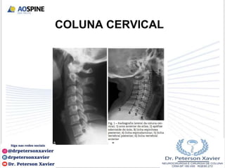 COLUNA CERVICAL
 