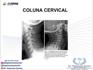 COLUNA CERVICAL
 