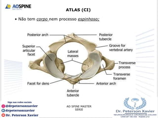 ATLAS (CI)
• Não tem corpo nem processo espinhoso;
AO SPINE MASTER
SERIE
 