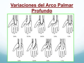 Variaciones del Arco Palmar
Profundo
 