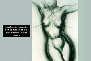 Localização do mamilo a 45 o  de  uma linha ideal com início na  fúrcula esternal 