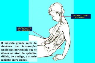 GRANDE  RECTO DO  ABDOMEN ESTERNO - CLEIDO MASTOIDEU O músculo grande recto do abdómen tem intersecções tendinosas horizontais que se situam ao nível do apêndice xifóide, do umbigo, e a meio caminho entre ambos.  
