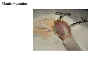 Fáscia muscular
 