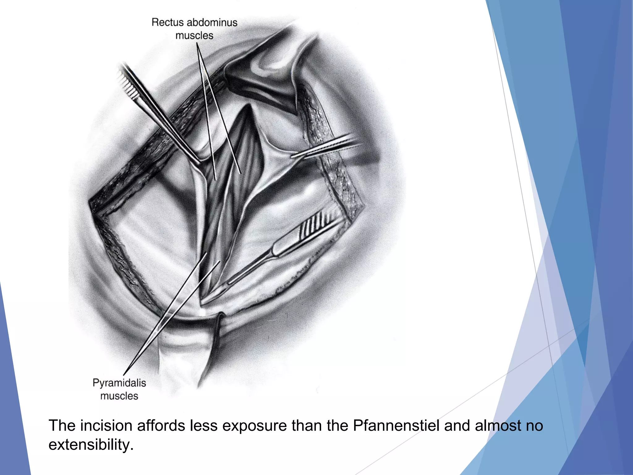 Abdominal incision and abdominal anatomy | PPT