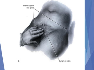 Abdominal incision and abdominal anatomy | PPT