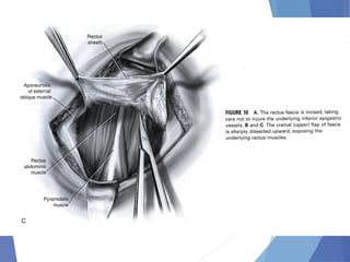 Abdominal incision and abdominal anatomy | PPT