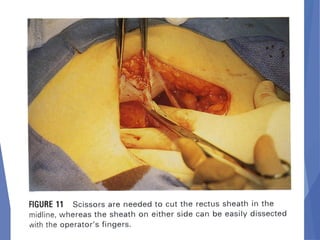 Abdominal incision and abdominal anatomy | PPT
