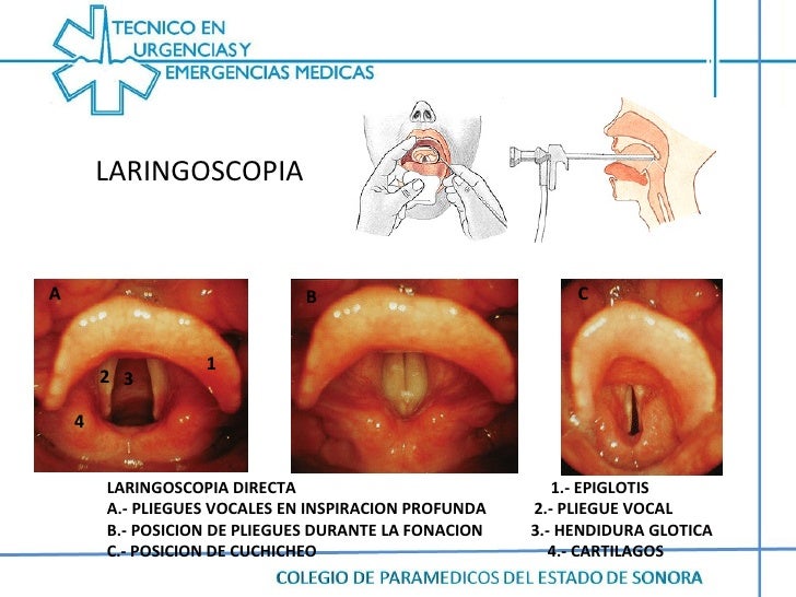 Differenza Tra Laringoscopia E Fibrolaringoscopia Anatomia cabeza