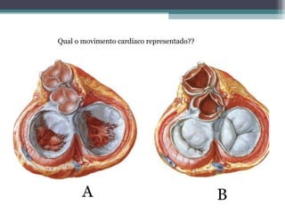Qual o movimento cardíaco representado??
A B
 