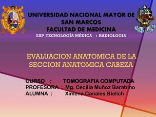 UNIVERSIDAD NACIONAL MAYOR DE SAN MARCOS FACULTAD DE MEDICINA EAP TECNOLOGÍA MÉDICA : RADIOLOGIA EVALUACION ANATOMICA DE LA SECCION ANATOMICA CABEZA 
CURSO : TOMOGRAFIA COMPUTADA PROFESORA : Mg. Cecilia Muñoz Barabino ALUMNA : Ximena Canales Bielich  