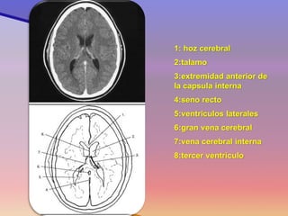 1: hoz cerebral 
2:talamo 
3:extremidad anterior de la capsula interna 
4:seno recto 
5:ventriculos laterales 
6:gran vena cerebral 
7:vena cerebral interna 
8:tercer ventrículo 
Corte 9  