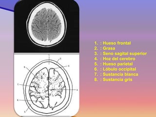 1.: Hueso frontal 
2.: Grasa 
3.: Seno sagital superior 
4.: Hoz del cerebro 
5.: Hueso parietal 
6.: Lóbulo occipital 
7.: Sustancia blanca 
8.: Sustancia gris  