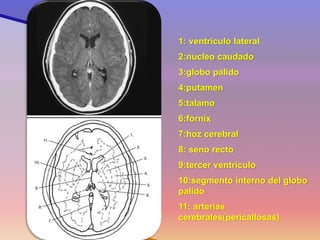 1: ventrículo lateral 
2:nucleo caudado 
3:globo pálido 
4:putamen 
5:talamo 
6:fornix 
7:hoz cerebral 
8: seno recto 
9:tercer ventrículo 
10:segmento interno del globo palido 
11: arterias cerebrales(pericallosas) 
Corte 8  