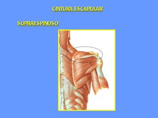 SUPRAESPINOSO CINTURA ESCAPULAR 