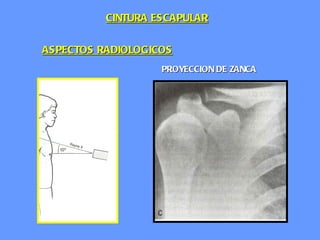 ASPECTOS RADIOLOGICOS PROYECCION DE ZANCA CINTURA ESCAPULAR 