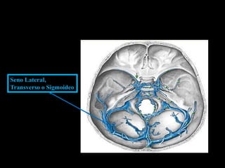 Seno Lateral,
Transverso o Sigmoideo
 