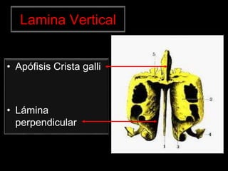 Lamina Vertical
• Apófisis Crista galli
• Lámina
perpendicular
 