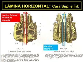 LÁMINA HORIZONTAL: Cara Sup. e Inf.
Lamina Cribosa
Hendidura
etmoidal
Canales
laterales
 