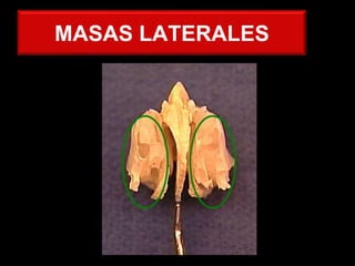 MASAS LATERALES
 