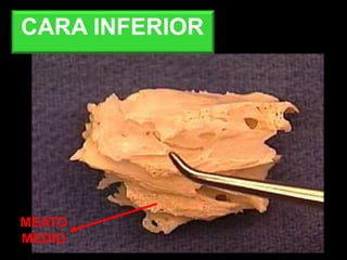 MEATO
MEDIO
CARA INFERIOR
 