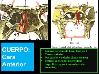 CUERPO:
Cara
Anterior
• Lamina horizontal ( Lam. Cribosa )
• Cresta anterior
• Dos canales verticales (fosas nasales)
• Entrada a los senos esfenoidales
• Superficie rugosa ( masas laterales
etmoides)
 