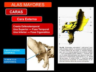 Cara Externa
Cresta Esfenotemporal
Una Superior --- Fosa Temporal
Una Inferior --- Fosa Cigomática
CARAS
ALAS MAYORES
CRESTA ESFENO
TEMPORAL
TUBERCULO
ESFENOIDAL
 