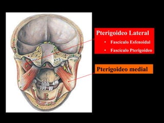 Pterigoideo medial
Pterigoideo Lateral
• Fascículo Esfenoidal
• Fascículo Pterigoideo
 
