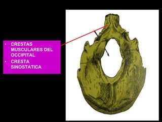 • CRESTAS
MUSCULARES DEL
OCCIPITAL
• CRESTA
SINOSTATICA
 