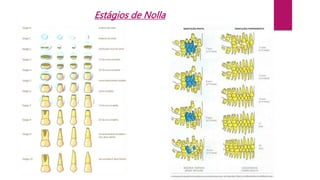 Estágios de Nolla
 