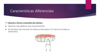 Características diferenciais
6º) Quanto a forma e tamanho dos dentes :
 Aspectos mais globoso que os permanentes
 Os decíduos são menores em todas as dimensões (1/3 menor em todas as
dimensões)
 